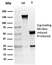 SDS-PAGE analysis of purified, BSA-free vWF/von Willebrand Factor antibody (clone VWF/4105) as confirmation of integrity and purity.
