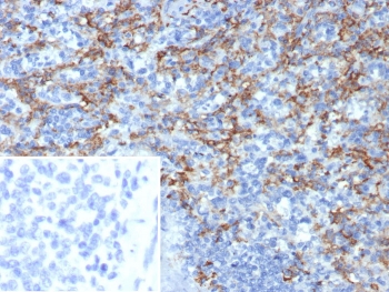 CD163L1 Antibody Spleen IHC. Immunohistochemistry staining of FFPE human spleen tissue using CD163L1 Antibody demonstrates distinct membranous and cytoplasmic HRP-DAB brown staining within macrophage-rich cellular populations distributed throughout the splenic tissue. The staining pattern is consistent with expression of CD163 Like 1 / CD163L1, a scavenger receptor family protein associated with monocyte-macrophage lineage cells and innate immune regulation. Clone CD163L1/7974 highlights immune cell populations involved in tissue surveillance, phagocytic activity, and maintenance of splenic immune homeostasis. Inset: PBS was used in place of the primary antibody as a secondary antibody negative control. HIER: boil tissue sections in pH 9 10mM Tris with 1mM EDTA for 20 min and allow to cool before testing.