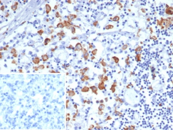CD163L1 Antibody Lymph Node IHC. Immunohistochemistry staining of FFPE human lymph node tissue using CD163L1 Antibody demonstrates distinct membranous and cytoplasmic HRP-DAB brown staining in scattered macrophage-like cells within the lymphoid microenvironment. The staining pattern is consistent with expression of CD163 Like 1 / CD163L1, a scavenger receptor family protein associated with monocyte-macrophage lineage populations and innate immune regulation. Clone CD163L1/7974 highlights immune cells involved in antigen processing, tissue surveillance, and maintenance of lymphoid tissue homeostasis. Inset: PBS was used in place of the primary antibody as a secondary antibody negative control. HIER: boil tissue sections in pH 9 10mM Tris with 1mM EDTA for 20 min and allow to cool before testing.