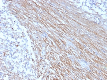 CD303 Antibody Placental Tissue IHC. Immunohistochemistry analysis of FFPE human placental tissue using CD303 Antibody (clone CLEC4C/3400) shows membranous and cytoplasmic staining in scattered immune cells within the tissue, consistent with CD303 / CLEC4C (BDCA2) expression on plasmacytoid dendritic cells. Positive cells are distributed within stromal regions, while surrounding structural elements display minimal background staining. Hematoxylin counterstain provides nuclear contrast and tissue architecture. HIER: boil FFPE tissue sections in pH 9 10 mM Tris with 1 mM EDTA for 20 min and allow to cool before testing.