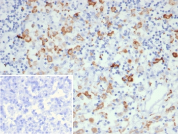 CD163L1 Antibody Human Lymph Node IHC. Immunohistochemistry staining of FFPE human lymph node tissue using CD163L1 antibody demonstrates distinct cytoplasmic and membranous HRP-DAB brown staining in scattered macrophage-like cells distributed throughout the lymphoid tissue. The staining pattern is consistent with expression of CD163 Like 1 / CD163L1, a scavenger receptor family protein associated with monocyte-macrophage lineage populations and innate immune regulation. Clone CD163L1/7971 highlights immune cells involved in tissue surveillance, antigen handling, and maintenance of lymphoid microenvironment homeostasis. Inset: PBS was used in place of the primary antibody as a secondary antibody negative control. HIER: boil tissue sections in pH 9 10mM Tris with 1mM EDTA for 20 min and allow to cool before testing.