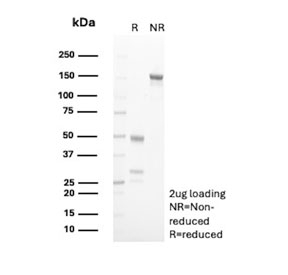 SDS-PAGE analysis of purified, BSA-free CD163L1 antibody (clone CD163L1/7972) as confirmation of integrity and purity.