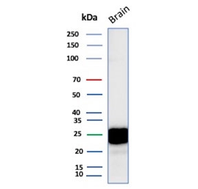 Western blot testing of human brain tissue lysate with CD9 antibody. Predicted molecular weight: 23-27 kDa.