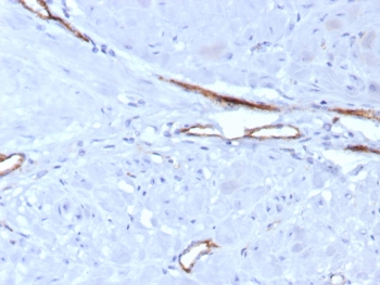 von Willebrand Factor Antibody / Tumor Vasculature Marker Antibody. Immunohistochemistry analysis of human uterus tissue shows HRP-DAB brown staining of endothelial cells lining vascular channels within stromal regions, forming elongated and irregular vessel structures embedded in the tissue microenvironment. The staining pattern emphasizes tumor-associated vascular architecture, with clearly defined endothelial linings outlining small vessels and branching channels distinct from surrounding stromal and smooth muscle cells. Clone VWF/7979R enables visualization of vascular distribution and vessel morphology within uterine tissue. HIER: boil tissue sections in pH 9 10mM Tris with 1mM EDTA for 20 min and allow to cool before testing.