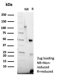 SDS-PAGE analysis of purified, BSA-free vWF/von Willebrand Factor antibody (clone VWF/7979R) as confirmation of integrity and purity.