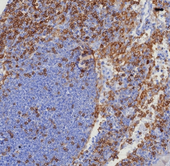 CD4 Antibody for IHC. Analysis of CD4 antibody staining in FFPE human tonsil tissue shows membranous labeling of CD4-positive T helper lymphocytes concentrated in interfollicular regions surrounding lymphoid follicles, highlighting immune-regulatory cell distribution within lymphoid tissue. This Immune Response Regulation Antibody (clone CD4/8203R) demonstrates selective detection of CD4-expressing cells involved in coordinating immune signaling and maintaining immune balance. Heat-induced epitope retrieval was performed by boiling tissue sections in pH 9 10 mM Tris with 1 mM EDTA for 20 minutes followed by cooling before testing.