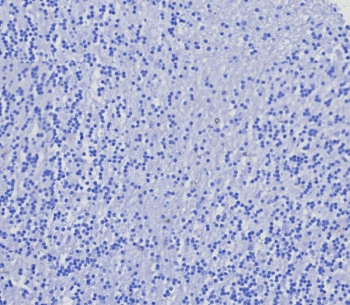 Negative control: IHC testing of FFPE human brain tissue with recombinant CD4 antibody (clone CD4/8203R) at 2ug/ml. HIER: boil tissue sections in pH 9 10mM Tris with 1mM EDTA for 20 min and allow to cool before testing.