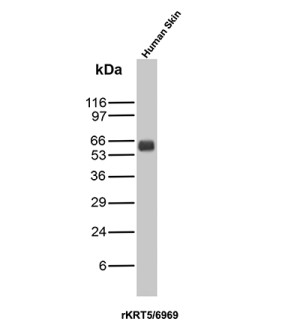 Western blot analysis of human skin tissue lysate using Recombinant KRT5 Antibody rKRT5/6969.