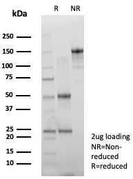 SDS-PAGE analysis of purified, BSA-free recombinant KRT7 antibody (clone rKRT7/8763) as confirmation of integrity and purity.