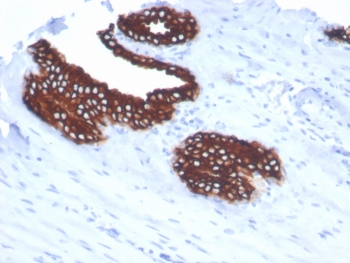Immunohistochemistry analysis of Keratin 18 / Cytokeratin 18 antibody (clone KRT18/7056R) in human prostate tissue. Formalin-fixed, paraffin-embedded human prostate tissue was stained using Keratin 18 antibody (clone KRT18/7056R). Heat-induced epitope retrieval was performed by boiling tissue sections in 10 mM Tris with 1 mM EDTA, pH 9.0, followed by cooling prior to antibody incubation. Brown chromogenic signal is observed in luminal epithelial cells of prostatic glands, with strong cytoplasmic staining outlining glandular epithelial structures, while surrounding stromal cells show little to no staining. This staining pattern reflects epithelial cell-associated expression of Cytokeratin 18 in prostate tissue.