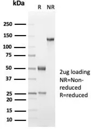 SDS-PAGE analysis of purified, BSA-free Keratin 18 antibody (clone KRT18/7056R) as confirmation of integrity and purity.