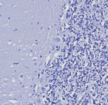Negative control: IHC testing of FFPE human brain tissue with Cytokeratin 5/6 antibody (clone KRT5.6/8275R) at 2ug/ml. HIER: boil tissue sections in pH 9 10mM Tris with 1mM EDTA for 20 min and allow to cool before testing.