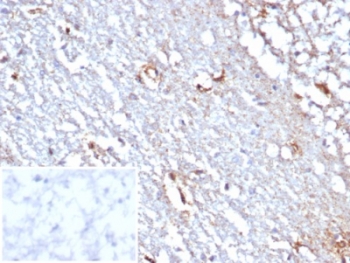 Immunohistochemistry analysis of STAT6 antibody in human cerebellum tissue (clone STAT6/7774R). FFPE human cerebellum sections demonstrate HRP-DAB brown staining predominantly in the cytoplasm and nuclei of scattered cells within the cerebellar cortex and white matter regions. The staining pattern is consistent with Signal transducer and activator of transcription 6 localization, reflecting its cytoplasmic presence with potential nuclear translocation upon activation. Background neuropil shows minimal non-specific staining. The inset shows PBS used in place of primary antibody as a secondary antibody negative control, demonstrating absence of specific brown staining. Heat induced epitope retrieval was performed by boiling tissue sections in pH 9 10 mM Tris with 1 mM EDTA for 20 minutes followed by cooling prior to antibody incubation.