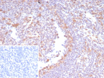 CDK4 Antibody Human Tonsil Tissue IHC. Immunohistochemistry staining of FFPE human tonsil tissue with CDK4 antibody (clone CDK4/8210R). Inset: PBS used in place of primary Ab (secondary Ab negative control). HIER: boil tissue sections in pH 9 10mM Tris with 1mM EDTA for 20 min and allow to cool before testing.