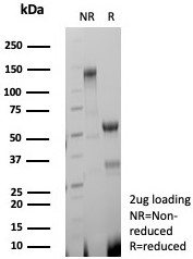 SDS-PAGE analysis of purified, BSA-free Decorin antibody rabbit monoclonal (clone DCN/8760R) as confirmation of integrity and purity.