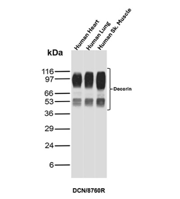Decorin Antibody Human Tissue Panel WB. Western blot analysis of human 1) heart, 2) lung, and 3) skeletal muscle tissue lysates using Decorin Antibody (clone DCN/8760R) detects multiple bands between approximately 50-120 kDa, consistent with glycosylated and partially processed forms of Decorin (DCN). The higher molecular weight bands reflect glycosaminoglycan-modified Decorin, while lower bands likely represent core protein or proteolytic fragments. The consistent banding pattern across tissues supports reliable detection of DCN and its post-translationally modified variants in extracellular matrix-rich samples.