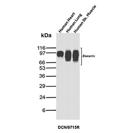 Western blot analysis of Decorin antibody in human tissues. Lysates from human heart, human lung, and human skeletal muscle were probed using recombinant rabbit monoclonal Decorin antibody (clone DCN/8715R). A prominent immunoreactive band is observed at approximately 90-100 kDa, consistent with the glycosylated form of Decorin. The predicted molecular weight of the Decorin core protein is approximately 40 kDa; however, Decorin is a proteoglycan that carries glycosaminoglycan side chains, resulting in a higher apparent molecular weight on SDS-PAGE. The banding pattern across multiple tissue types is consistent with extracellular matrix-associated Decorin expression.