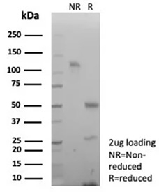 SDS-PAGE analysis of purified, BSA-free Decorin antibody recombinant rabbit mAb clone DCN/8715R as confirmation of integrity and purity.