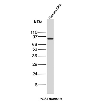 Periostin Antibody Skin WB. Western blot analysis of Periostin / POSTN expression in human skin tissue lysate using recombinant Periostin antibody, clone POSTN/8951R. Lane 1: human skin tissue lysate. A band is detected at approximately 75-90 kDa, consistent with the predicted molecular weight of periostin, with migration variability reflecting glycosylation and isoform diversity characteristic of this secreted extracellular matrix protein.