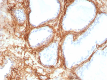 Periostin Antibody Lung IHC. Immunohistochemistry analysis of Periostin / POSTN expression in FFPE human lung tissue using recombinant Periostin antibody, clone POSTN/8951R. HRP-DAB brown staining highlights extracellular matrix deposition along alveolar septa and peribronchial connective tissue, forming fibrous networks surrounding airspaces, while epithelial cells show minimal intracellular signal; nuclei are counterstained blue. Antigen retrieval was performed by boiling sections in 10 mM Tris buffer with 1 mM EDTA, pH 9, for 20 min followed by cooling at room temperature.