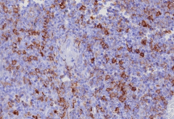IHC staining of FFPE human tonsil tissue with PSGL-1 antibody (clone PSGL1/8192R). HIER: boil tissue sections in pH 9 10mM Tris with 1mM EDTA for 20 min and allow to cool before testing.