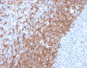 IHC staining of FFPE human tonsil tissue with IgD Antibody IGHD/2730R. HIER: boil tissue sections in pH 9 10mM Tris with 1mM EDTA for 20 min and allow to cool before testing.