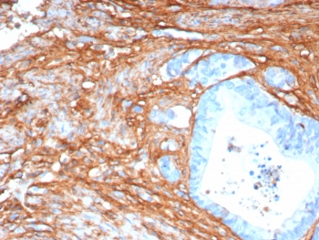 Immunohistochemistry of Periostin antibody in human colon tissue. Formalin-fixed, paraffin-embedded human colon was stained with recombinant rabbit monoclonal Periostin antibody (clone POSTN/8165R) following heat-induced epitope retrieval by boiling in pH 9 10 mM Tris with 1 mM EDTA for 20 minutes and cooling prior to testing. HRP-DAB brown chromogenic signal highlights stromal and pericryptal extracellular matrix regions surrounding colonic glands, consistent with the secreted and matrix-associated localization of Periostin, while epithelial cell nuclei remain largely negative.
