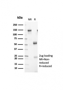 SDS-PAGE analysis of purified, BSA-free recombinant Retinoblastoma antibody (clone RB1/7080R) as confirmation of integrity and purity.