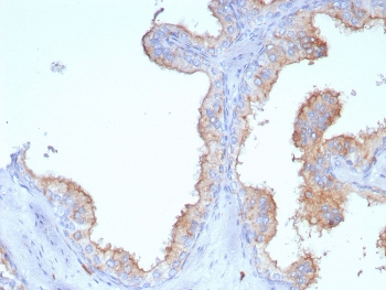 CD107a Antibody Human Prostate IHC. Immunohistochemical staining of FFPE human prostate tissue using CD107a antibody (clone LAMP1/7457) following heat-induced epitope retrieval in pH9 Tris-EDTA buffer. Staining was visualized using an HRP secondary antibody with DAB chromogen. Membranous and cytoplasmic staining is observed in the prostate epithelium, consistent with the lysosomal localization of CD107a (Lysosomal Associated Membrane Protein 1). This result demonstrates that the CD107a antibody is suitable for detecting endogenous LAMP1 expression in FFPE human prostate tissue.
