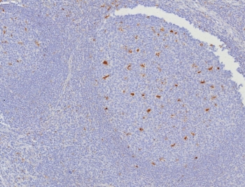CD107a Antibody Human Tonsil IHC. Immunohistochemical staining of FFPE human tonsil tissue using CD107a antibody (clone LAMP1/7457) following heat-induced epitope retrieval in pH9 Tris-EDTA buffer. Staining was visualized using an HRP secondary antibody with DAB chromogen. Distinct membranous and cytoplasmic staining is observed in scattered immune cells within the tonsil, consistent with the expression pattern of CD107a (Lysosomal Associated Membrane Protein 1) in activated lymphocytes and other immune cell populations. This result demonstrates that the CD107a antibody is suitable for detecting endogenous LAMP1 expression in FFPE human lymphoid tissue.