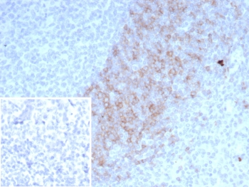 IgD Heavy Chain Antibody Mouse Monoclonal IGHD/4967 immunohistochemistry analysis of human lymph node tissue. Formalin-fixed paraffin-embedded human lymph node tissue stained with IgD Heavy Chain Antibody Mouse Monoclonal IGHD/4967 shows HRP-DAB brown chromogenic staining in B lymphocytes within lymphoid follicles, with positive cells predominantly localized in mantle zone regions surrounding germinal centers. Staining is observed along the cell membrane and within the cytoplasm of IgD-positive B cells consistent with expression of Immunoglobulin D in mature naive B lymphocytes. The inset shows the negative control in which PBS was used in place of the primary antibody, demonstrating absence of specific staining. Heat induced epitope retrieval was performed by boiling tissue sections in pH 9 10mM Tris with 1mM EDTA for 20 minutes followed by cooling prior to antibody incubation.