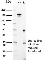 SDS-PAGE analysis of purified, BSA-free mouse monoclonal IgD Heavy Chain antibody (clone IGHD/4967) as confirmation of integrity and purity.