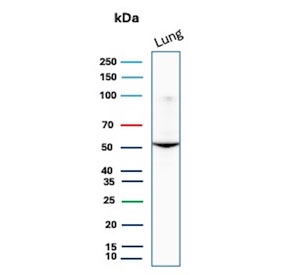 Western blot testing of human lung tissue lysate with AAT antibody. Expected molecular weight: 47-52 kDa depending on the level of glycosylation.
