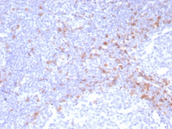 Recombinant IgD Heavy Chain Antibody IGHD/8228R immunohistochemistry analysis of human tonsil tissue. Formalin-fixed paraffin-embedded human tonsil tissue stained with Recombinant IgD Heavy Chain Antibody IGHD/8228R shows HRP-DAB brown chromogenic staining in B lymphocytes within lymphoid follicles. Positive cells are distributed primarily in mantle zone regions surrounding germinal centers and display membranous and cytoplasmic staining consistent with IgD expression in mature naive B cells. Heat induced epitope retrieval was performed by boiling tissue sections in pH 9 10mM Tris with 1mM EDTA for 20 minutes followed by cooling prior to antibody incubation.