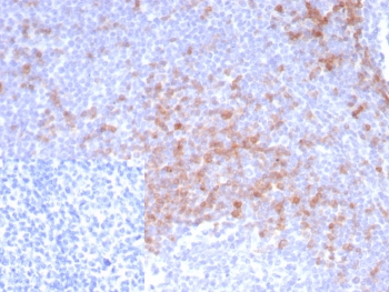 Recombinant IgD Heavy Chain Antibody IGHD/8228R immunohistochemistry analysis of human tonsil tissue. Formalin-fixed paraffin-embedded human tonsil tissue stained with Recombinant IgD Heavy Chain Antibody IGHD/8228R shows HRP-DAB brown chromogenic staining in B lymphocytes within lymphoid follicles, with positive cells distributed predominantly in mantle zone regions surrounding germinal centers. Staining is localized to the cell membrane and cytoplasm of IgD-positive B cells consistent with expression of Immunoglobulin D in mature naive B lymphocytes. The inset shows the negative control in which PBS was used in place of the primary antibody, demonstrating absence of specific staining. Heat induced epitope retrieval was performed by boiling tissue sections in pH 9 10mM Tris with 1mM EDTA for 20 minutes followed by cooling prior to antibody incubation.
