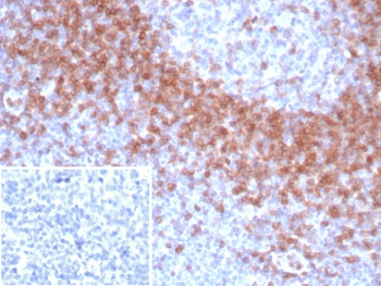 IgD Antibody Recombinant Rabbit MAb IGHD/8367R immunohistochemistry analysis of human tonsil tissue. Formalin-fixed paraffin-embedded human tonsil tissue stained with IgD Antibody Recombinant Rabbit MAb IGHD/8367R shows HRP-DAB brown chromogenic staining in B lymphocytes within lymphoid follicles, with strong membranous and cytoplasmic signal in mantle zone B cells surrounding germinal centers. Germinal center lymphocytes display reduced staining compared with mantle zone populations. The inset shows the negative control in which PBS was used in place of the primary antibody, confirming absence of specific staining. Heat induced epitope retrieval was performed by boiling tissue sections in pH 9 10mM Tris with 1mM EDTA for 20 minutes followed by cooling prior to antibody incubation.