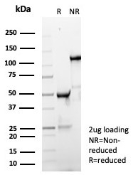 SDS-PAGE analysis of purified, BSA-free rabbit monoclonal IgD antibody (clone IGHD/8367R) as confirmation of integrity and purity.