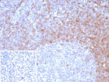 IgD Antibody Rabbit Monoclonal IGHD/8326R immunohistochemistry analysis of human tonsil tissue. Formalin-fixed paraffin-embedded human tonsil tissue stained with IgD Antibody Rabbit Monoclonal IGHD/8326R shows HRP-DAB brown chromogenic staining in B lymphocytes within lymphoid follicles, with strong membranous and cytoplasmic signal in mantle zone B cells surrounding germinal centers. Germinal center cells show reduced staining relative to the mantle zone population. The inset shows the negative control in which PBS was used in place of the primary antibody, demonstrating absence of specific staining. Heat induced epitope retrieval was performed by boiling tissue sections in pH 9 10mM Tris with 1mM EDTA for 20 minutes followed by cooling prior to antibody incubation.