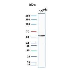 Western blot testing of human lung tissue lysate with SERPINA1 antibody. Expected molecular weight: 47-52 kDa depending on the level of glycosylation.