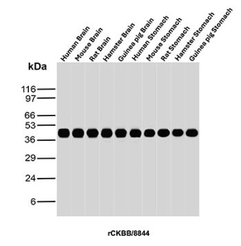 Western blot analysis of Human Brain, Mouse Brain, Rat Brain, Hamster Brain, Guinea pig Brain, Human Stomach, Mouse Stomach, Rat Stomach, Hamster Stomach and Guinea pig Stomach tissue lysates using recombinant CKBB antibody (clone rCKBB/8844). Predicted molecular weight ~43 kDa.
