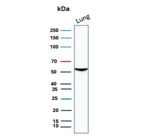Western blot testing of human lung tissue lysate with Alpha-1-Antitrypsin antibody. Expected molecular weight: 47-52 kDa depending on the level of glycosylation.