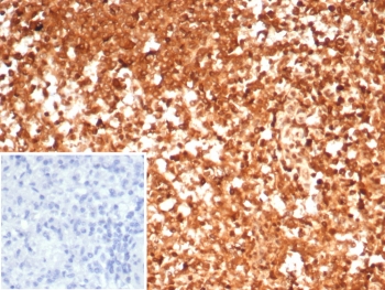 HSP90AA1 Antibody Spleen IHC. Immunohistochemistry staining of FFPE human spleen tissue using HSP90AA1 Antibody / Molecular Chaperone Antibody (clone HSP90AA1/7426) demonstrates strong diffuse cytoplasmic HRP-DAB brown staining throughout splenic lymphoid cell populations. The staining pattern is consistent with expression of HSP90AA1 (HSP90 alpha), a highly conserved ATP-dependent molecular chaperone that regulates protein folding, stabilization of client proteins, signal transduction, and maintenance of cellular homeostasis. HSP90AA1 is broadly expressed in immune cells where it supports proteostasis, stress-response pathways, and the functional activity of numerous signaling proteins. The inset image shows the negative control in which PBS was used in place of the primary antibody. HIER was performed by boiling tissue sections in pH 9, 10 mM Tris with 1 mM EDTA for 20 minutes followed by cooling prior to immunostaining.