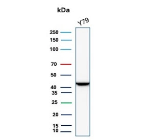 Brain Creatine Kinase Antibody Y79 WB. Western blot analysis of human Y79 cell lysate using Brain Creatine Kinase antibody. The mouse monoclonal antibody clone CKBB/6568 detects a band at approximately 43 kDa, consistent with the predicted molecular weight of Creatine kinase B / CKB. Detection in Y79 neuroblastoma-derived cells aligns with the neuronal lineage and energy homeostasis function of this cytosolic enzyme, supporting its use as a neuronal energy homeostasis marker in western blot analysis.