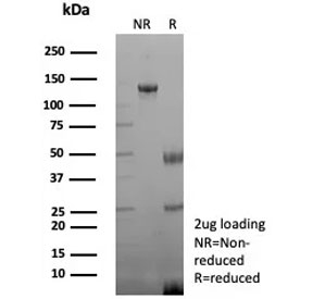SDS-PAGE analysis of purified, BSA-free recombinant Creatine kinase B antibody (clone rCKBB/8841) as confirmation of integrity and purity.