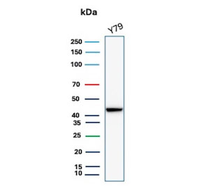 Creatine Kinase B Antibody for WB Human Y79 Cells. Western blot testing of human Y79 cell lysate with recombinant Creatine kinase B antibody. Predicted molecular weight ~43 kDa.
