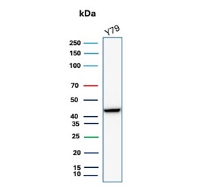 CKBB Antibody Retinoblastoma WB. Western blot testing of human retinoblastoma Y79 cell lysate with CKBB antibody. Predicted molecular weight ~43 kDa.