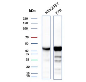 CKBB Antibody WB. Western blot testing of human HEK293 and Y79 cell lysate with CKBB antibody. Predicted molecular weight ~43 kDa.