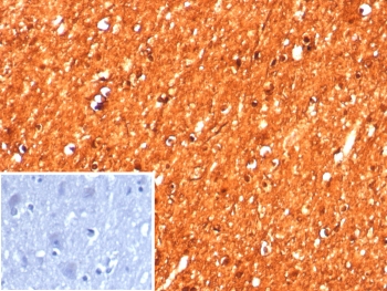 Creatine Kinase B Antibody Human Brain IHC. Immunohistochemistry analysis of FFPE human brain tissue using Creatine Kinase B antibody. The recombinant rabbit monoclonal antibody clone CKBB/8608R demonstrates strong, diffuse cytoplasmic staining in neurons, highlighting Creatine kinase B / CKB as a neuronal cytoplasmic marker. Neuronal cell bodies and processes show robust signal, while surrounding non-neuronal elements display comparatively lower staining, supporting its use in identifying metabolically active neuronal populations. A PBS-only control confirms minimal non-specific staining. HIER: boil tissue sections in 10 mM Tris with 1 mM EDTA, pH 9, for 20 min followed by cooling prior to staining.