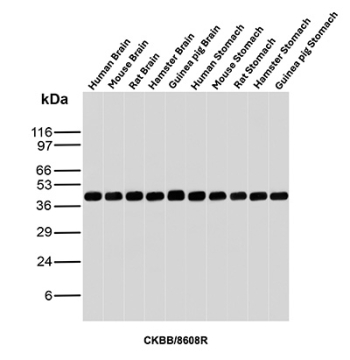 Creatine Kinase B Antibody Human Mouse Rat Hamster Guinea Pig Brain and Stomach WB. Western blot analysis of human brain, mouse brain, rat brain, hamster brain, guinea pig brain, human stomach, mouse stomach, rat stomach, hamster stomach, and guinea pig stomach tissue lysates using Creatine Kinase B antibody. The recombinant rabbit monoclonal antibody clone CKBB/8608R detects a band at approximately 43 kDa, consistent with the predicted molecular weight of Creatine kinase B / CKB. Strong and consistent detection in brain samples aligns with the known neuronal enrichment of this cytosolic enzyme, supporting its role as a neuronal cytoplasmic marker and confirming reliable cross-species performance in western blot analysis.