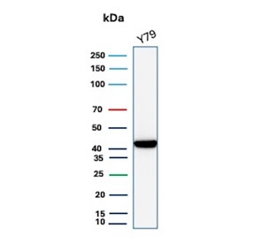 Creatine Phosphokinase BB Antibody Y79 Cell WB. Western blot testing of human Y79 cell lysate with Creatine phosphokinase BB antibody (clone CKBB/8609R). Predicted molecular weight ~43 kDa.